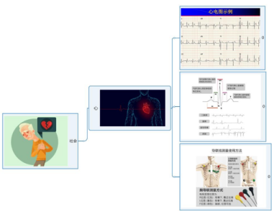 心电图监护仪方案